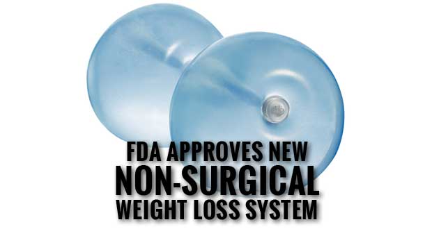 FDA Approves ReShape Dual Balloon System for Weight Loss